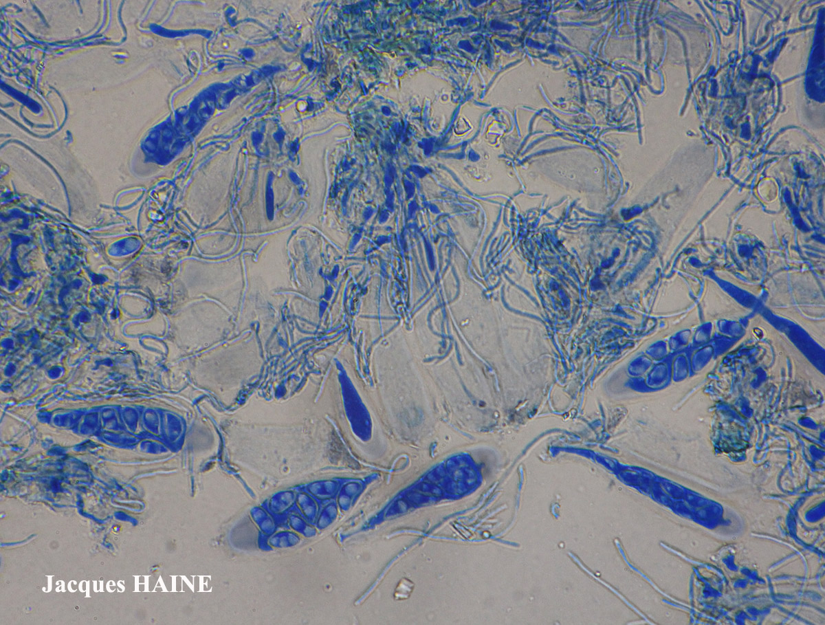 Lecidella Cf. sp.
